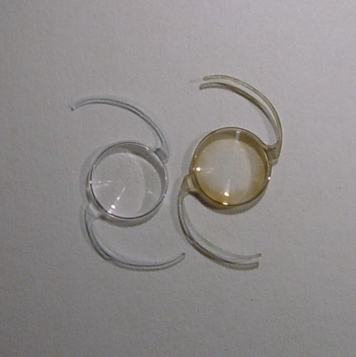 Mit einem Niederdruckplasma-Verfahren gereinigte Implantationslinse (links) und ungereinigte Linse (rechts).