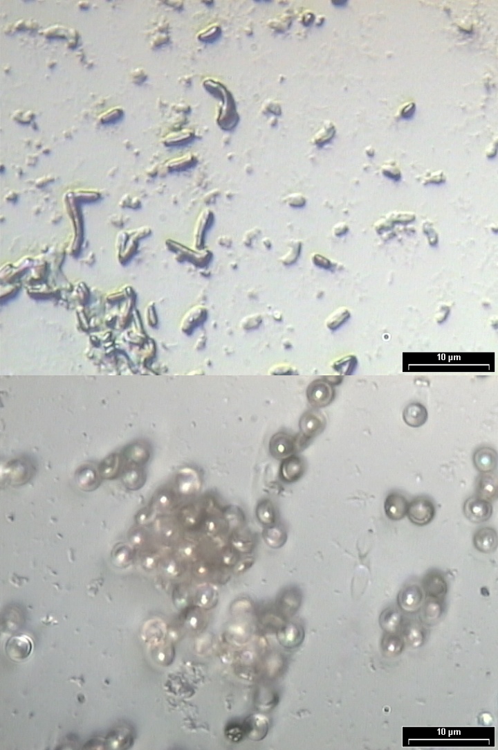 Microscope pictures of spores: Bacillus subtilis (top) and Aspergillus niger (bottom).
