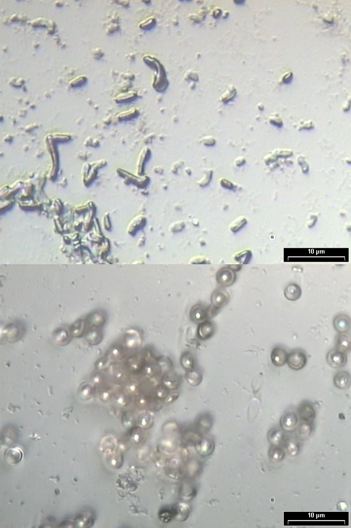 Mikroskopaufnahmen von Bacillus subtilis (oben) und Aspergillus niger Sporen (unten).